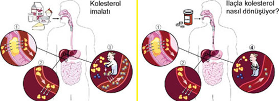Ldl Kolesterol Belirtileri